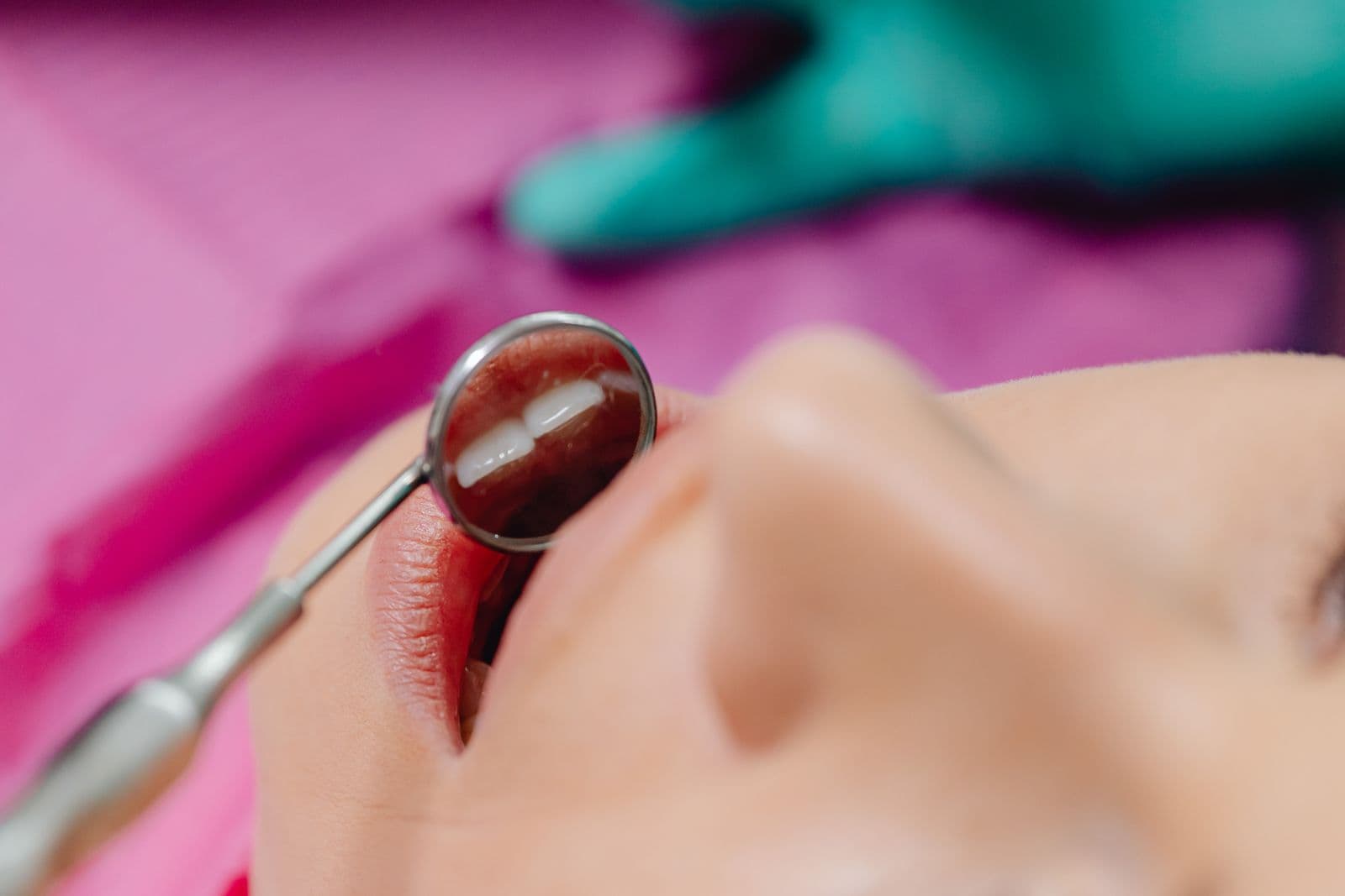 A close-up of a dental examination with the dentist's tools in a patient's mouth.